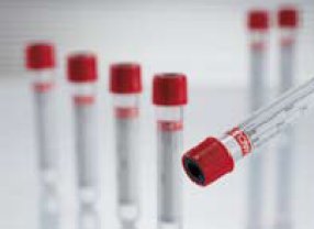 VACUETTE® Z Serum Sep Clot Activator Venous Blood Collection Tube Serum Tube Clot Activator / Separator Gel Additive 16 X 100 mm 8 mL Red / Yellow Ring Pull Cap Polyethylene Terephthalate (PET) Tube (50/PK 24PK/CS) by Greiner Bio-One  ID 455071P